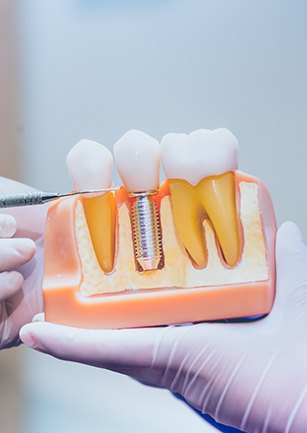 Dentist pointing to a dental implant model